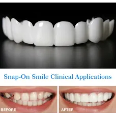 Накладные виниры для зубов Snap on smile с кейсом съемные