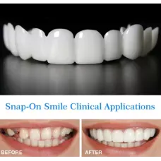Накладные виниры для зубов Snap on smile с кейсом съемные