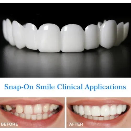 Накладные виниры для зубов Snap on smile с кейсом съемные - фото 6
