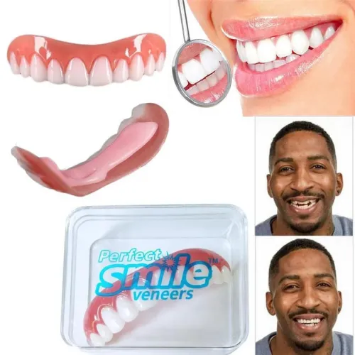 Виниры для зубов Perfect smile veneers. Голливудская улыбка
