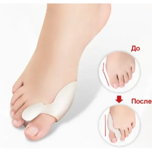 Силіконовий коректор великого пальця Valgus Pro, бандаж вальгусний - фото 3