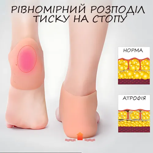 Силіконовий захист п'яти AND267, силіконовий фіксатор для п'ят від мозолів і тріщин, бандаж на п'яту - фото 5