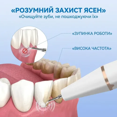 Ультразвуковий скалер для видалення зубного каменю Teeth Cleaner HY-46 з LED підсвіткою та 2 насадками - фото 2
