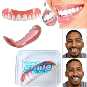 Вініри для зубів Perfect smile veneers. Голлівудська усмішка