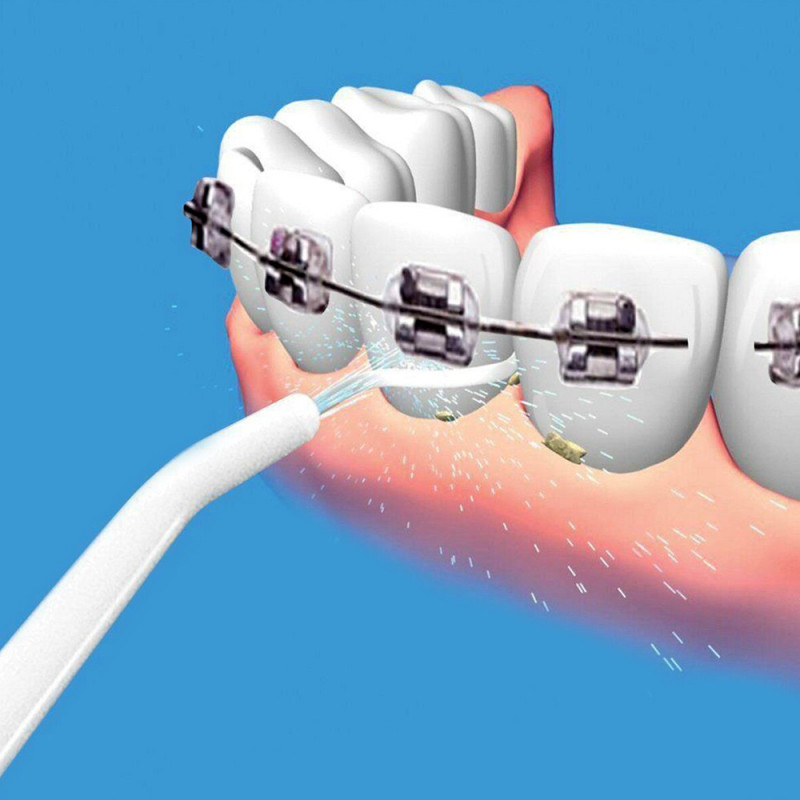 Водный ополаскиватель для зубов Power Floss ирригатор для полости рта фото - 7
