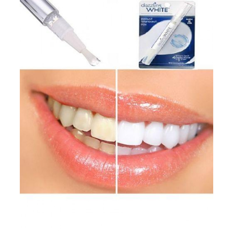 Карандаш для отбеливания зубов Teeth Whitening Pen фото - 2