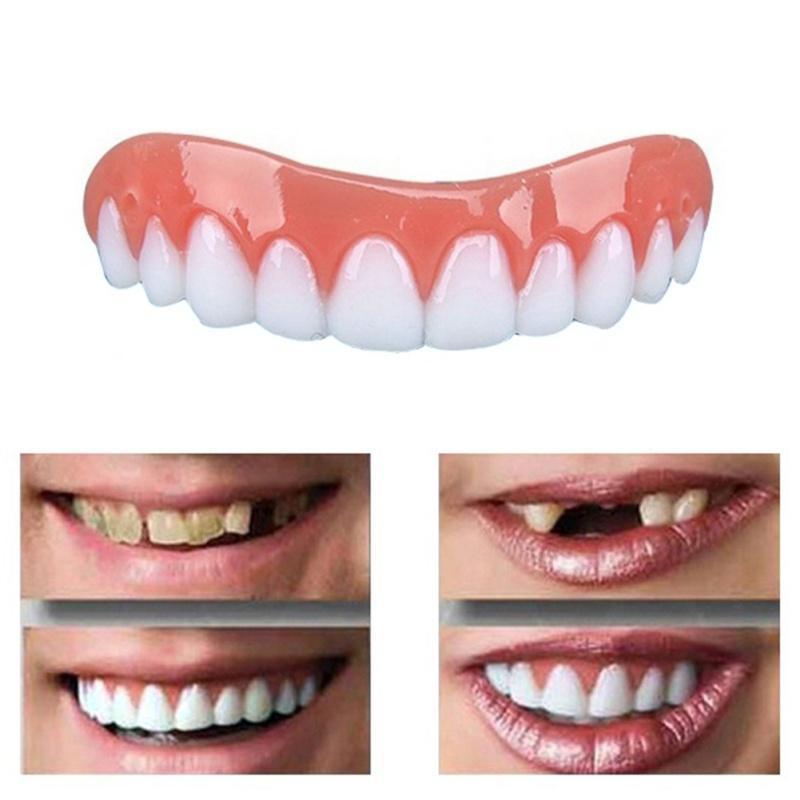 Вініри для зубів Perfect smile veneers. Голлівудська усмішка фото - 6